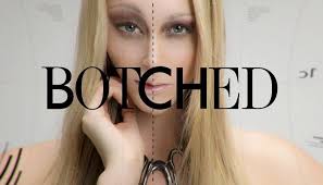 Botched - Season 1